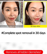 Load image into Gallery viewer, Some by mi Yuja Niacin Blemish Care Serum (Pigmentation and Blemishes) - Nyasia.ae
